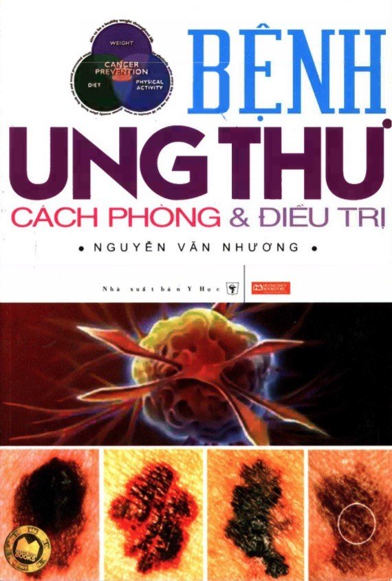 Bệnh Ung Thư Cách Phòng Và Điều Trị