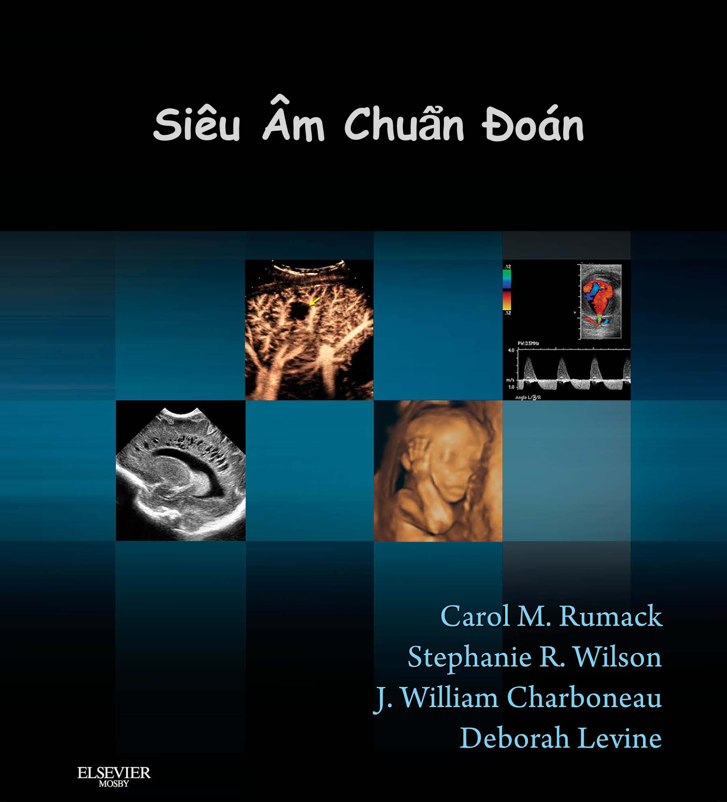 Siêu Âm Chẩn Đoán – Diagnostic Ultrasound